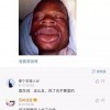 医生，我还有救吗？全本免费在线阅读大作等你来！
